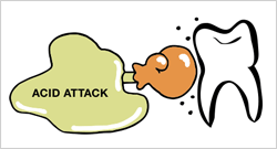 asidattack
