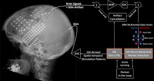 رمزگشایی از سیگنال های پزشکی با هوش مصنوعی