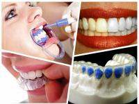 sefidkerdandandanbalayzer