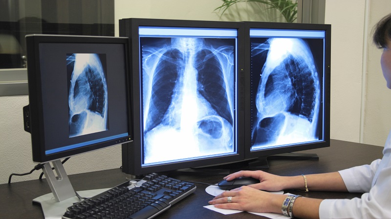 radiogerafidigital
