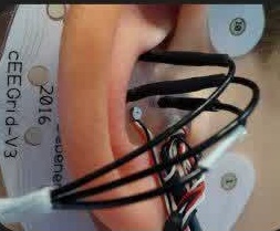 برچسب کنترل مغز